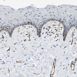 ECE-1 Antibody, Novus Biologicals:Antibodies:Primary Antibodies